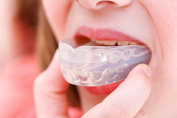 preventative-mouthguard